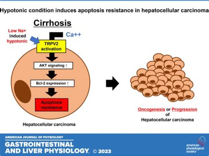 What causes Hypoosmolarity