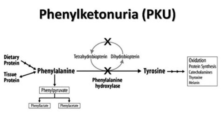 What causes phenylketonuria