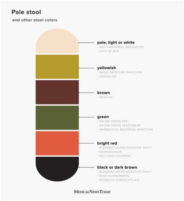What color is a pale stool