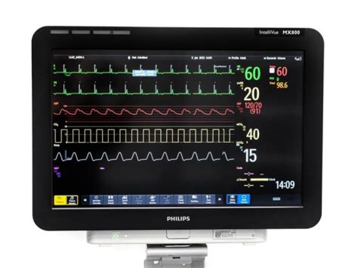 What do PACU nurses monitor
