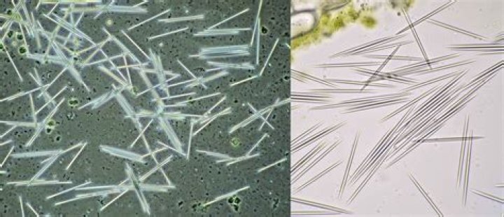What do Raphide crystals do