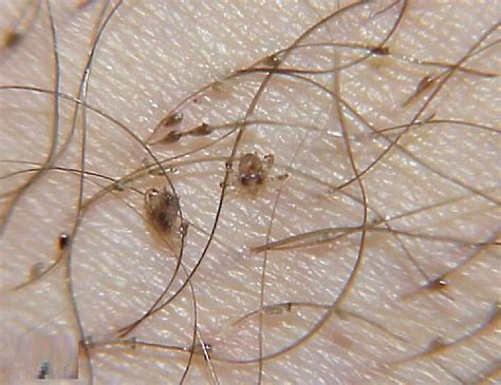 What do STD crabs look like