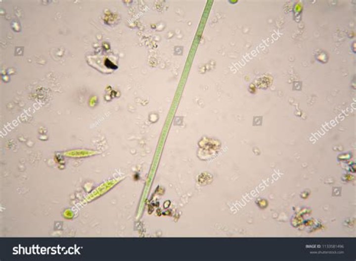 What do you see in pond water under a microscope