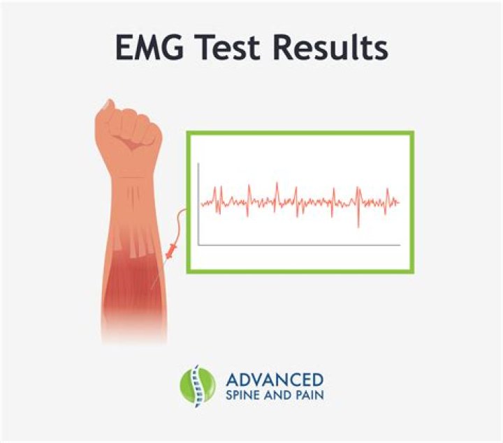 What does a normal EMG mean