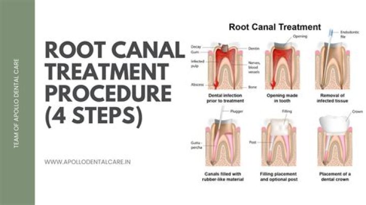 What does a root booster do