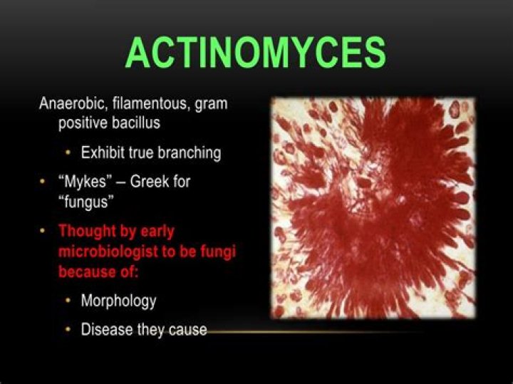 What does Actinomyces cause