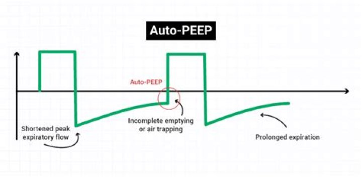 What does Auto PEEP mean