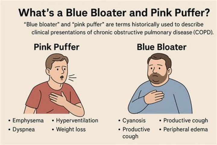 What does blue bloater mean