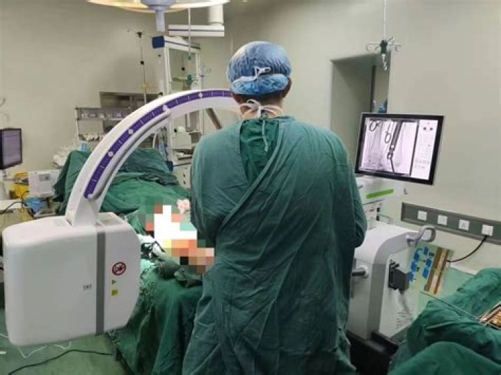 What does C-arm machine do