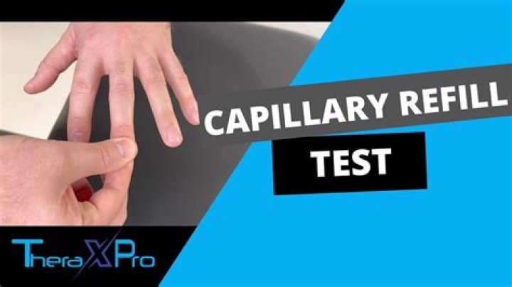 What does cap refill assess