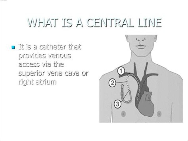 What does Central line mean