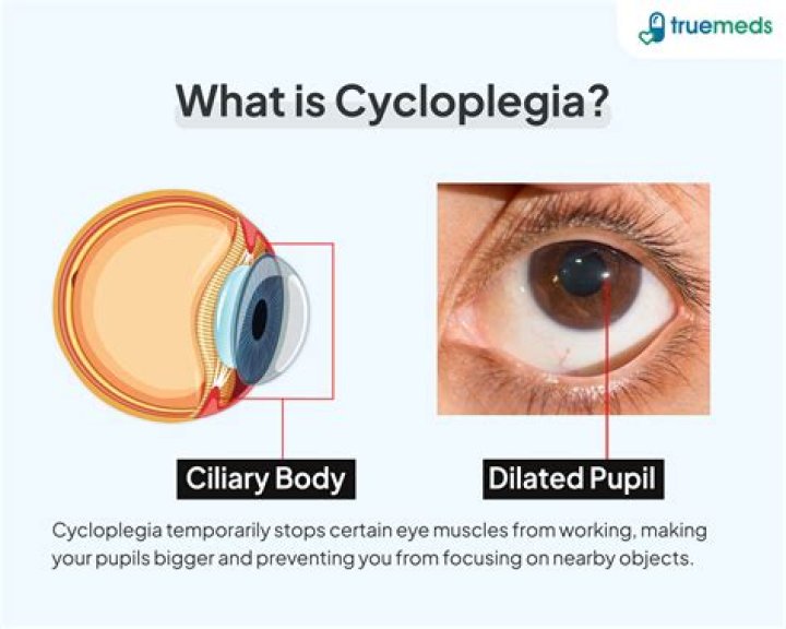 What does cycloplegia mean