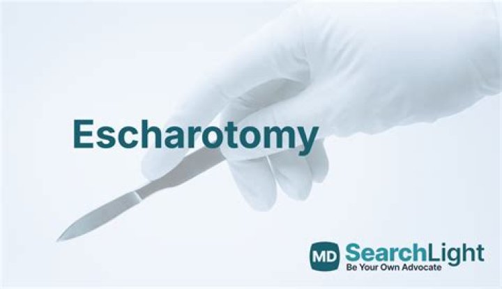 What does escharotomy mean