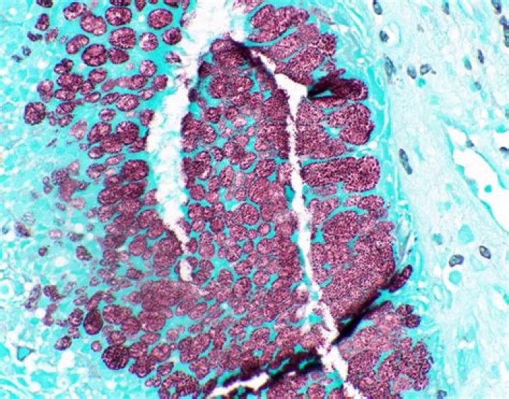 What does GMS Stain detect