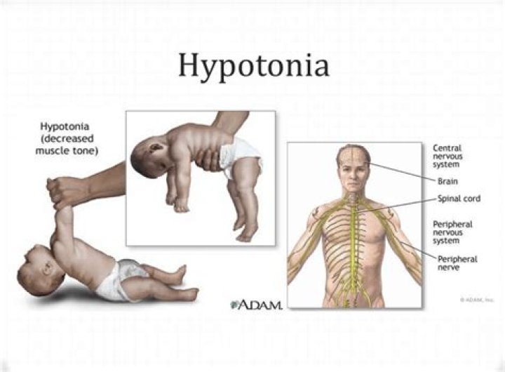 What does increased muscle tone mean