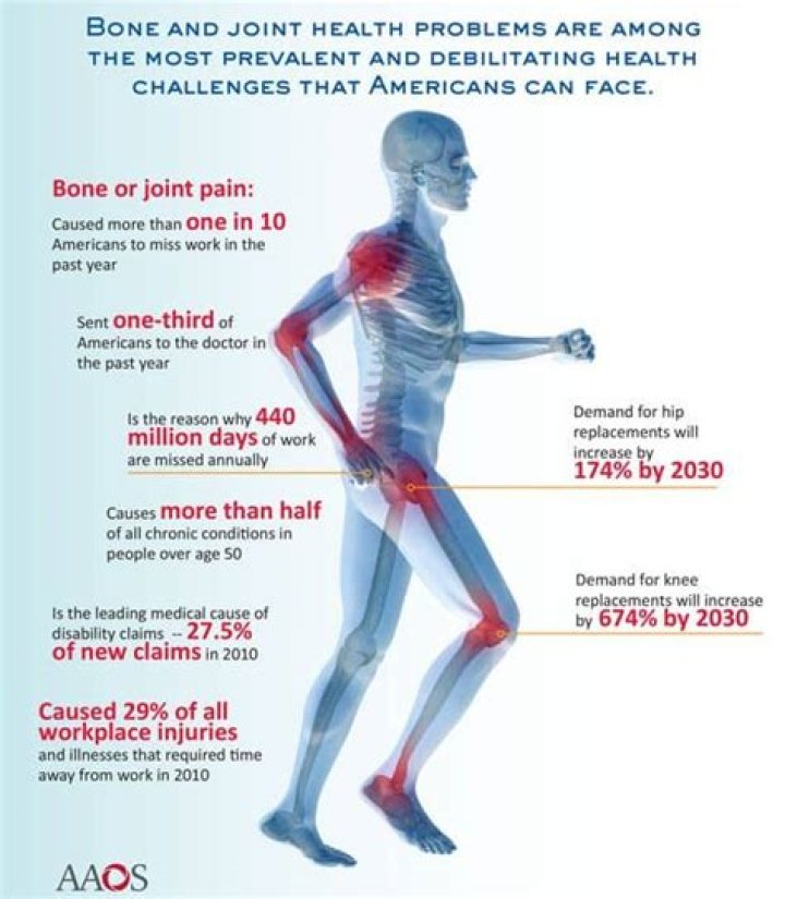 What does joint health mean