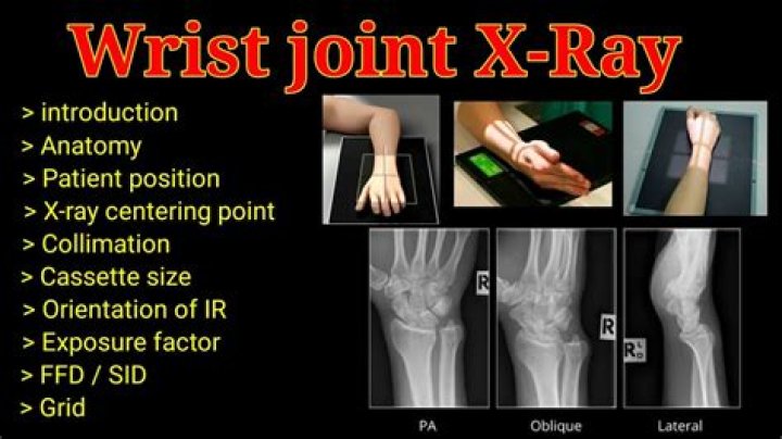What does pa stand for xray