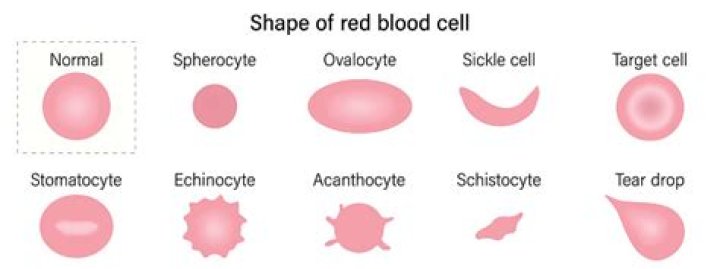 What does Schistocytes mean