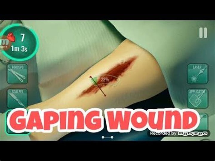 What does wound gaping mean