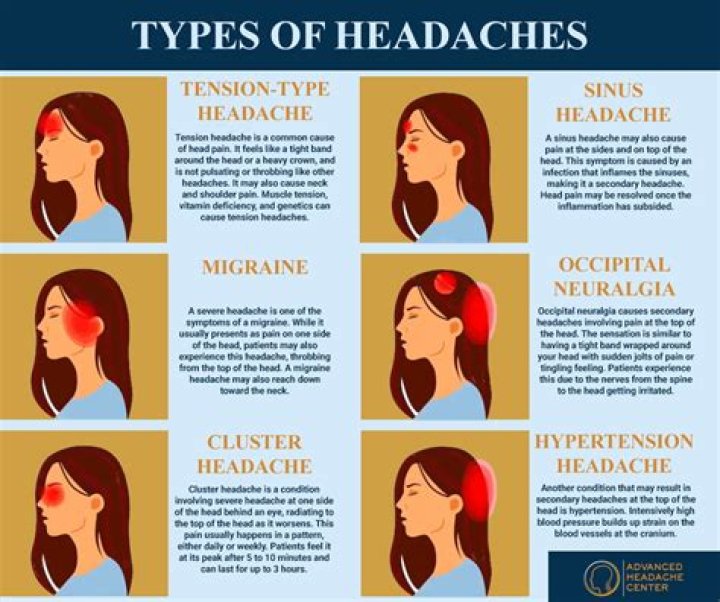 What exactly is a headache