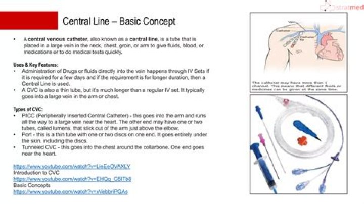 What is a central line procedure