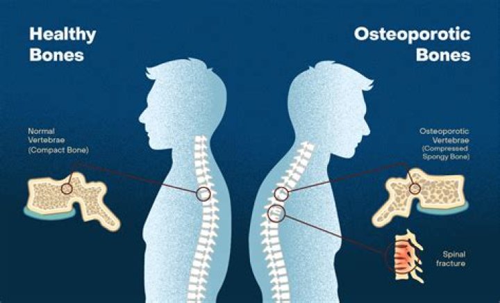 What is a good indicator of bone health