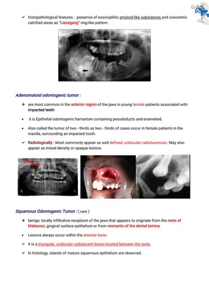 What is a odontogenic tumor