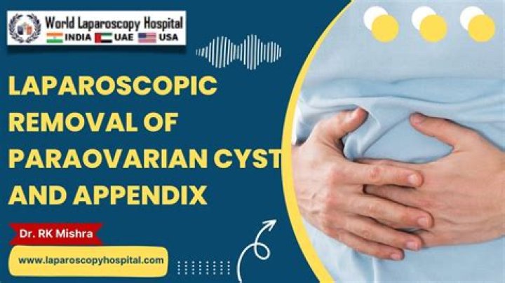 What is a Paraovarian cyst