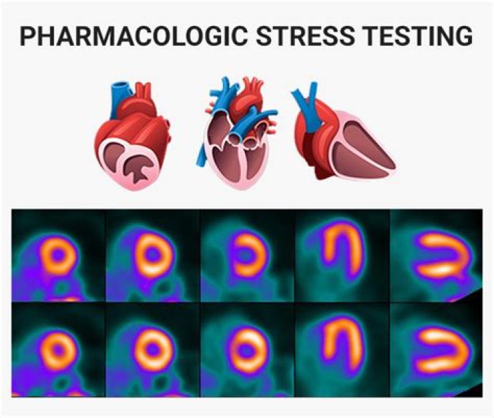 What is a Pharm stress test