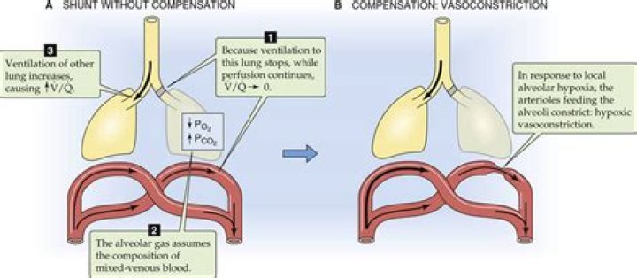 What is a physiologic shunt