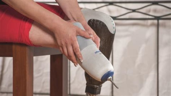 What is a prosthetic sleeve