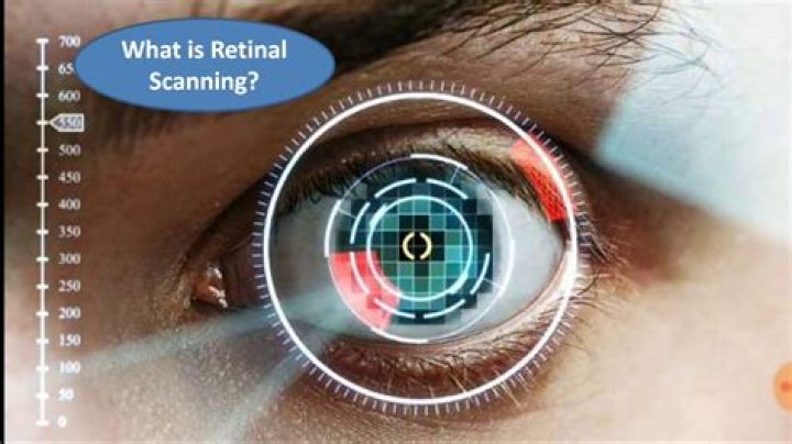 What is a retinal screening