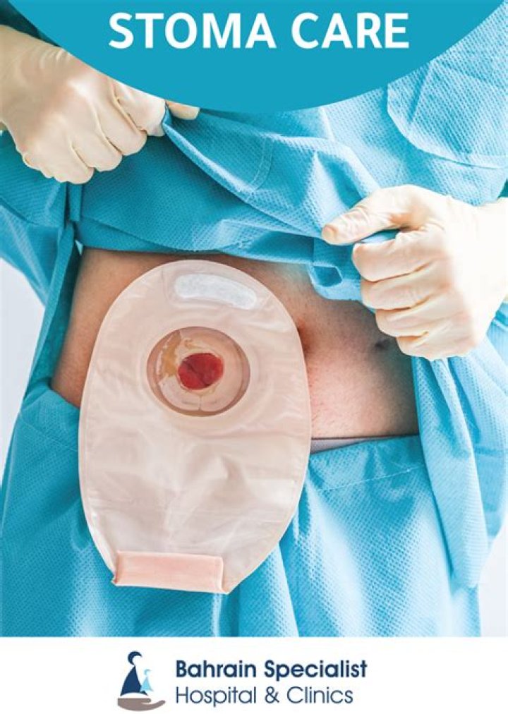 What is a stoma specialist