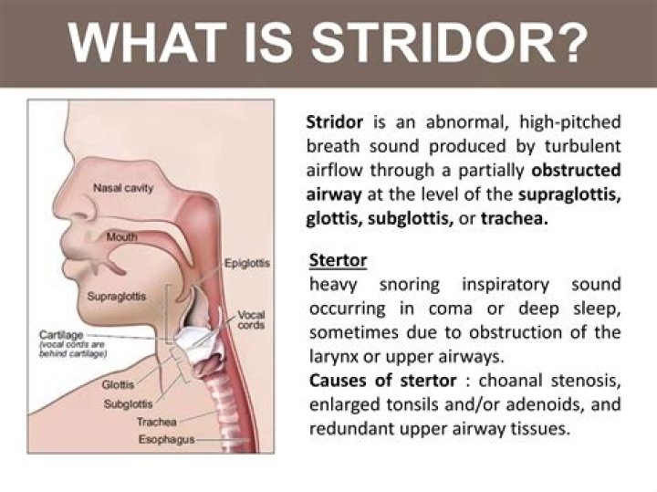 What is a stridor breathing