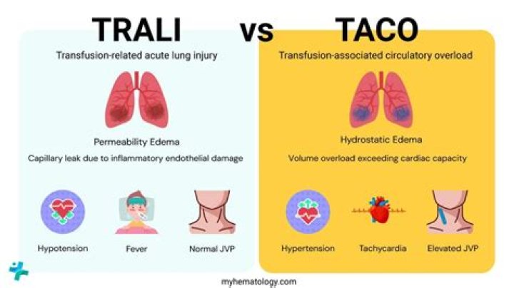 What is a Trali
