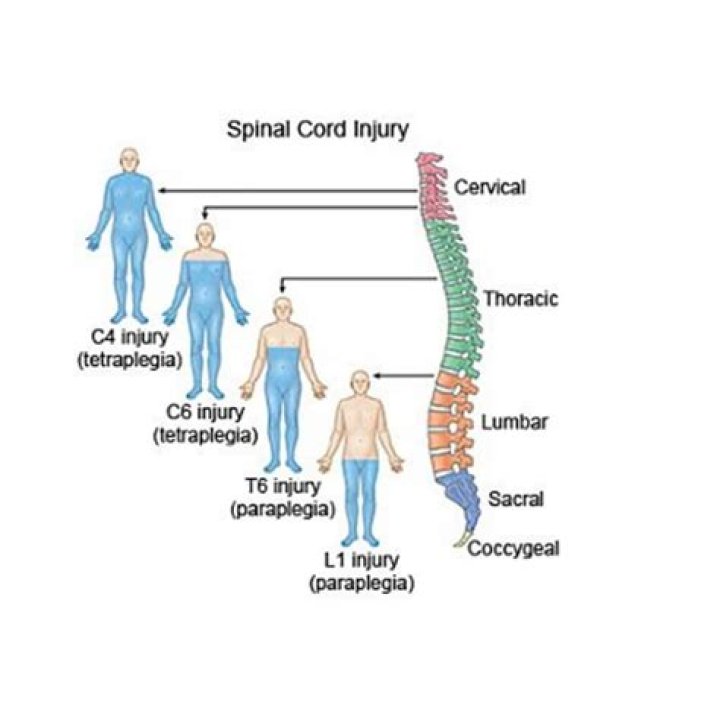What is a trunk injury on a human body