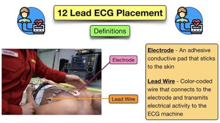 What is an electrode in ECG