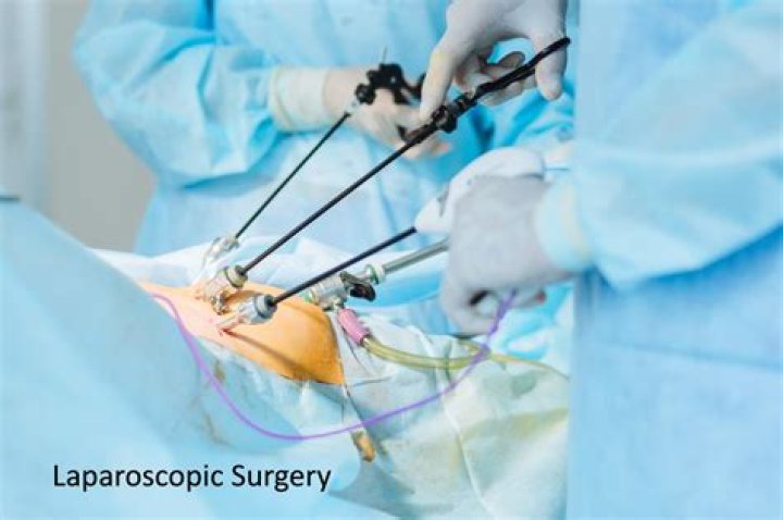 What is an open laparoscopy