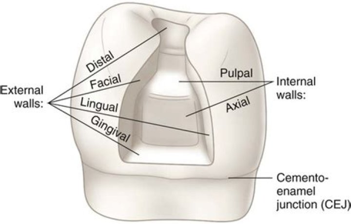 What is axial wall of tooth