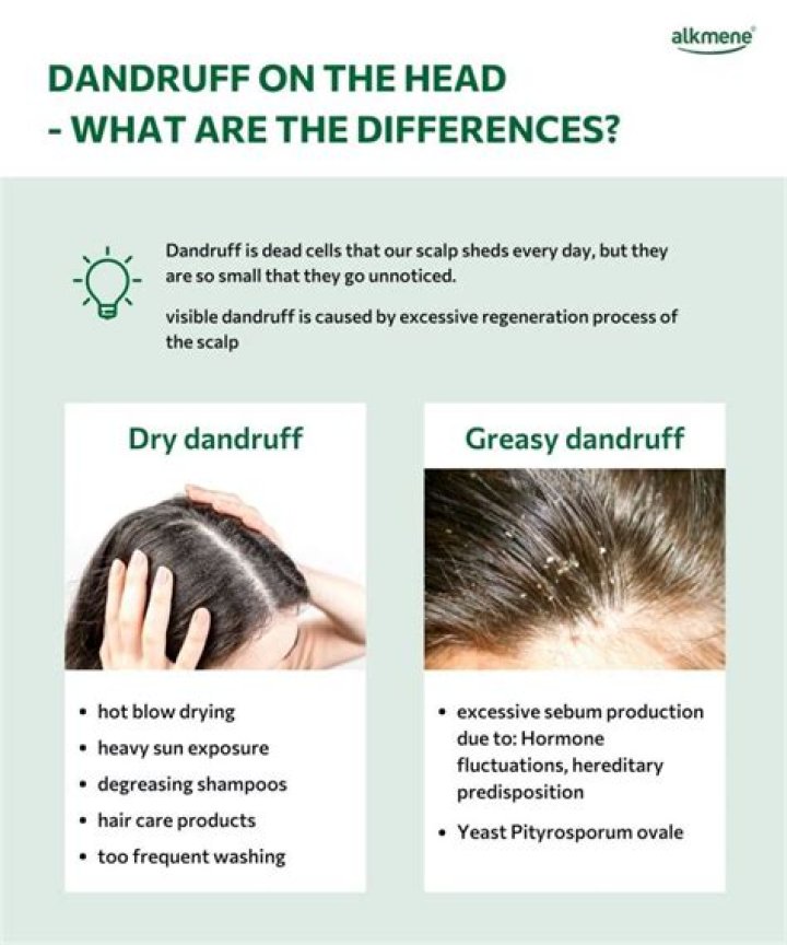 What is dandruff caused by