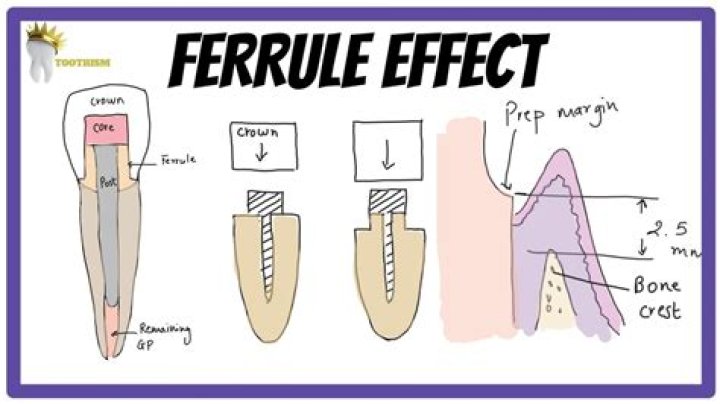 What is ferrule made out of