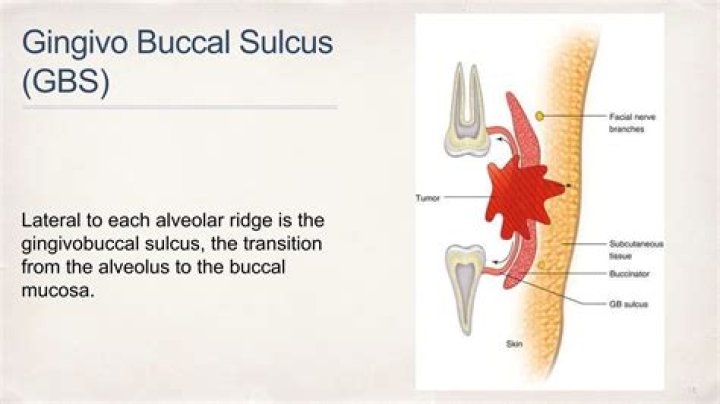 What is Gingivolabial sulcus