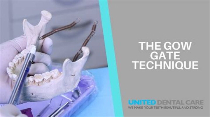 What is Gow Gates technique