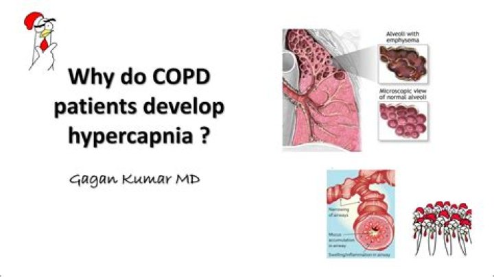 What is hypercapnia in COPD