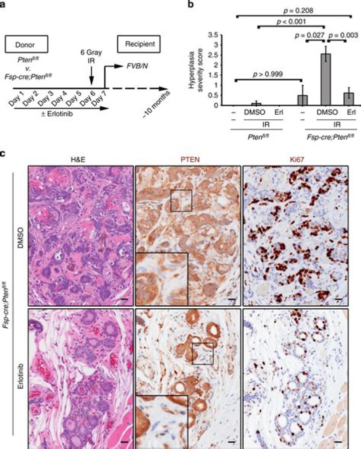 What is mammary hyperplasia
