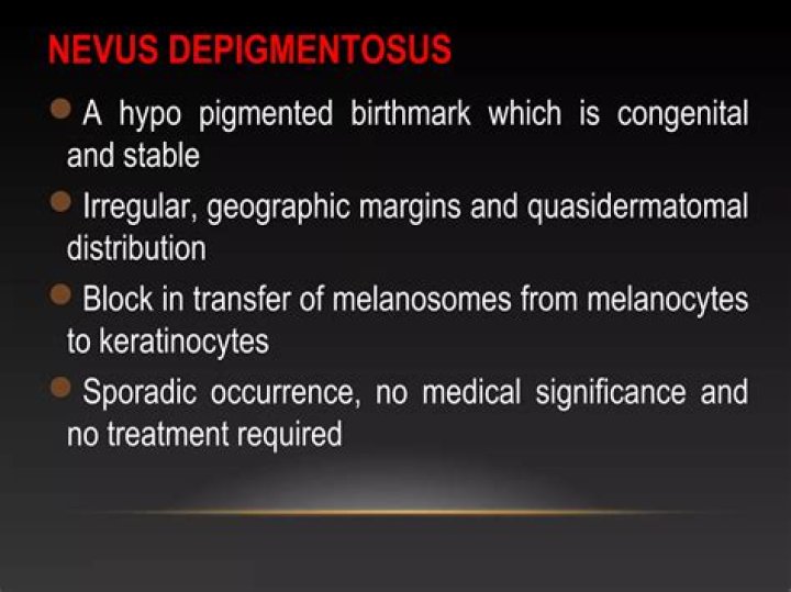 What is nevus Depigmentosus