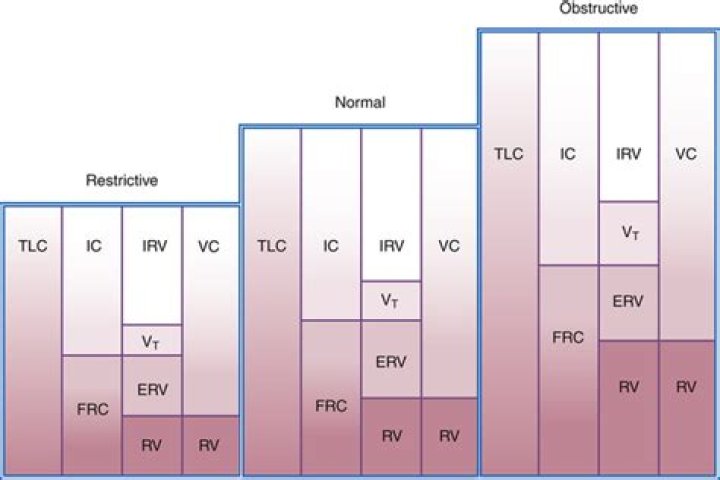 What is normal RV TLC ratio