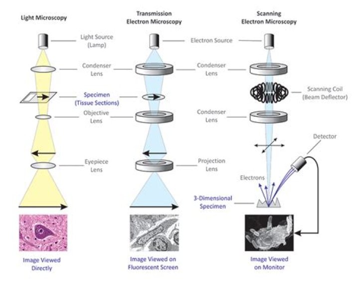 What is one advantage of a light microscope over an electron microscope