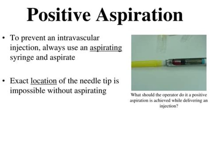 What is positive aspiration