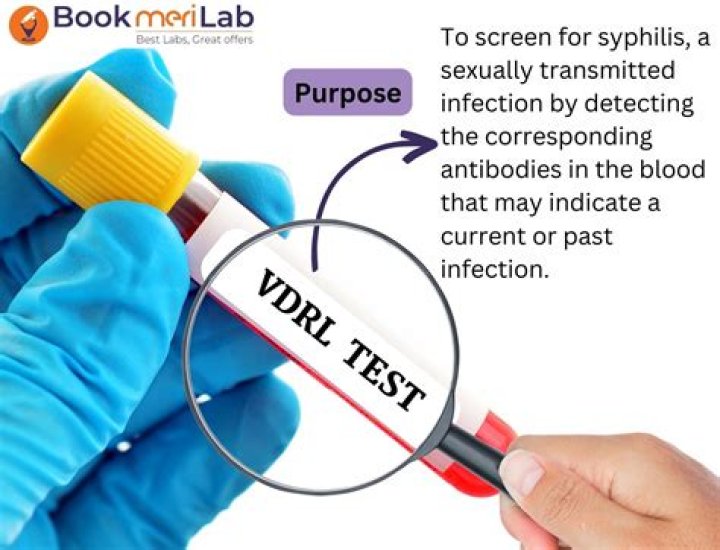 What is RPR Vdrl blood test